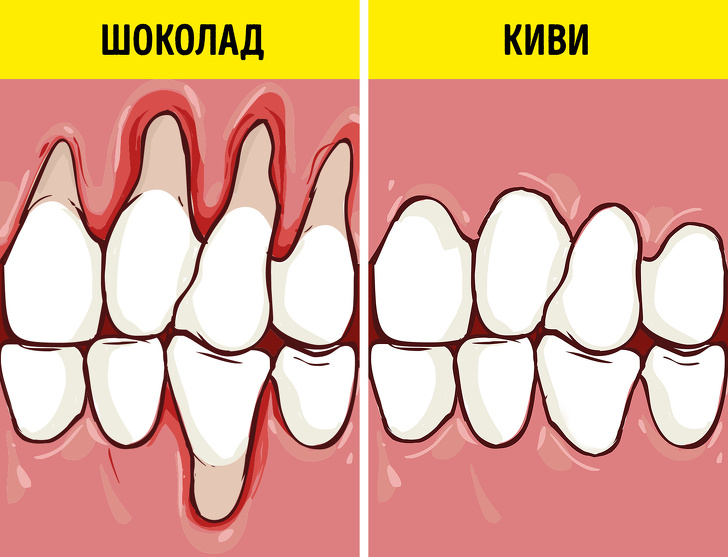 Как сохранить здоровье зубов и отбелить их с помощью еды