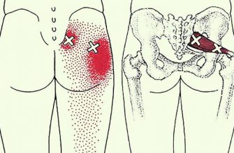 2 трюка, которые разблокируют седалищный нерв и облегчат боль в течение нескольких минут!