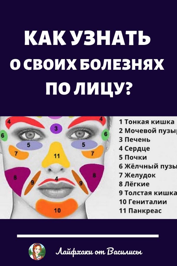 Как узнать о своих болезнях по лицу?