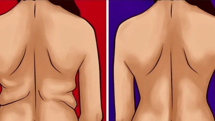 Как избавиться от складок на спине: несложные и эффективные упражнения