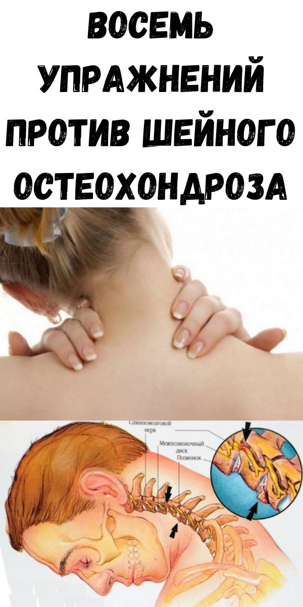 Восемь упражнений против шейного остеохондроза