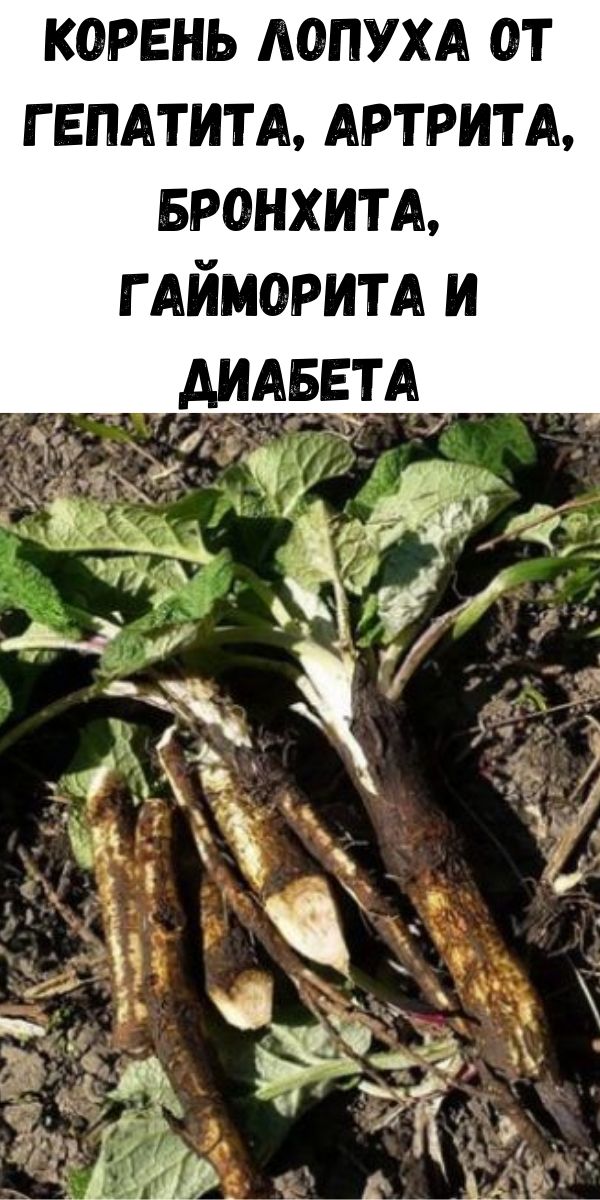 Корень лопуха от гепатита, артрита, бронхита, гайморита и диабета