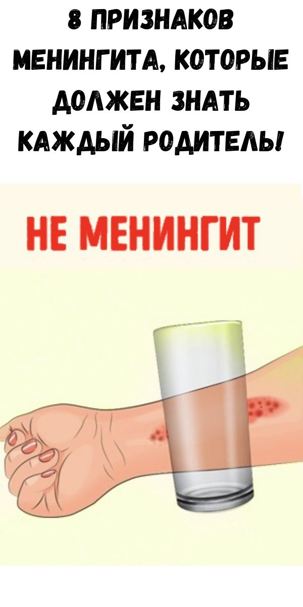 8 признаков менингита, которые должен знать каждый родитель!