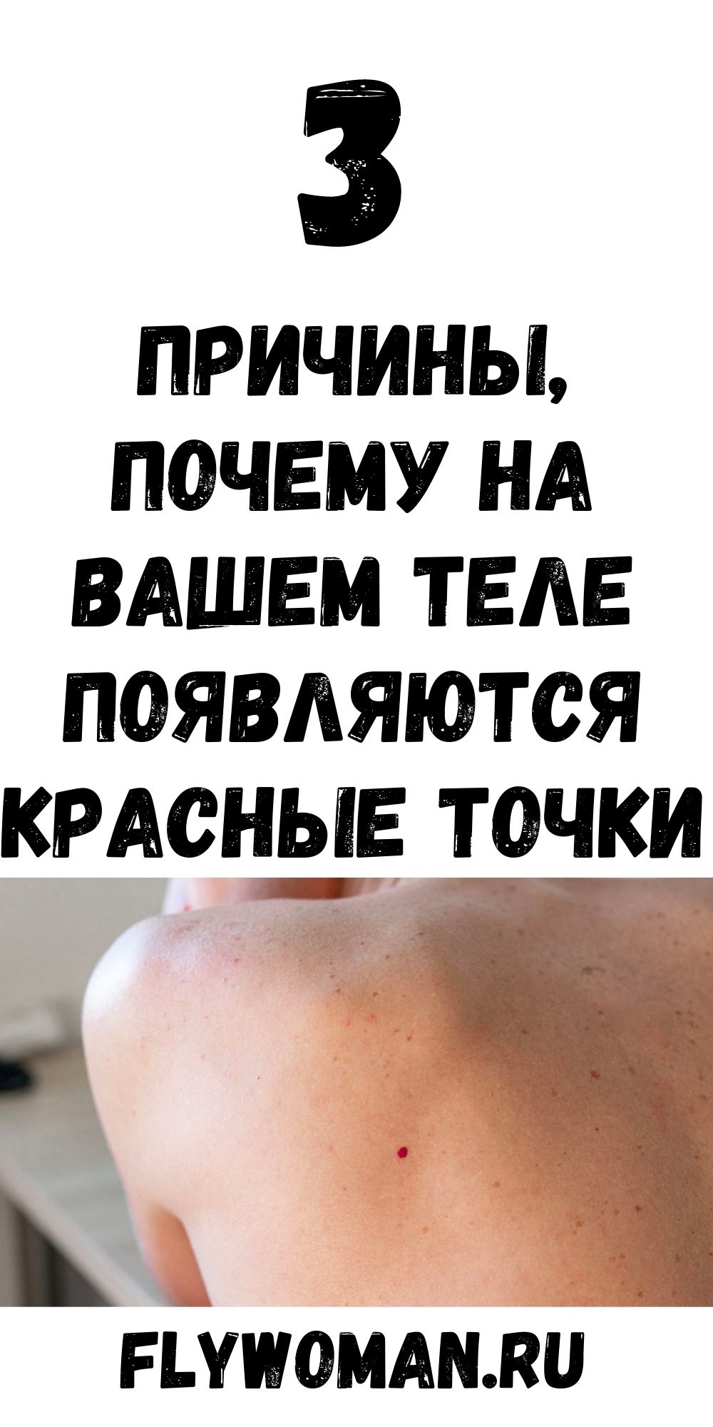 У вас есть красные точки на теле? Знайте - это симптом Тужилина!