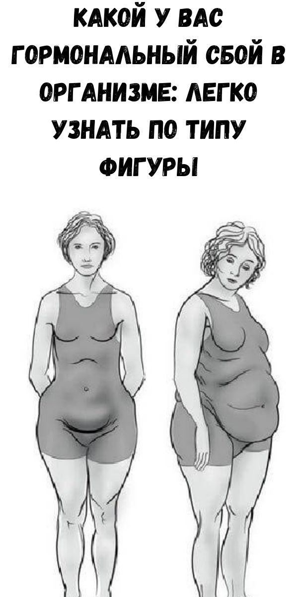 Какой у вас гормональный сбой в организме: Легко узнать по типу фигуры