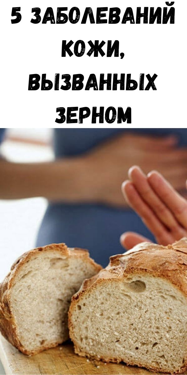 5 заболеваний кожи, вызванных зерном