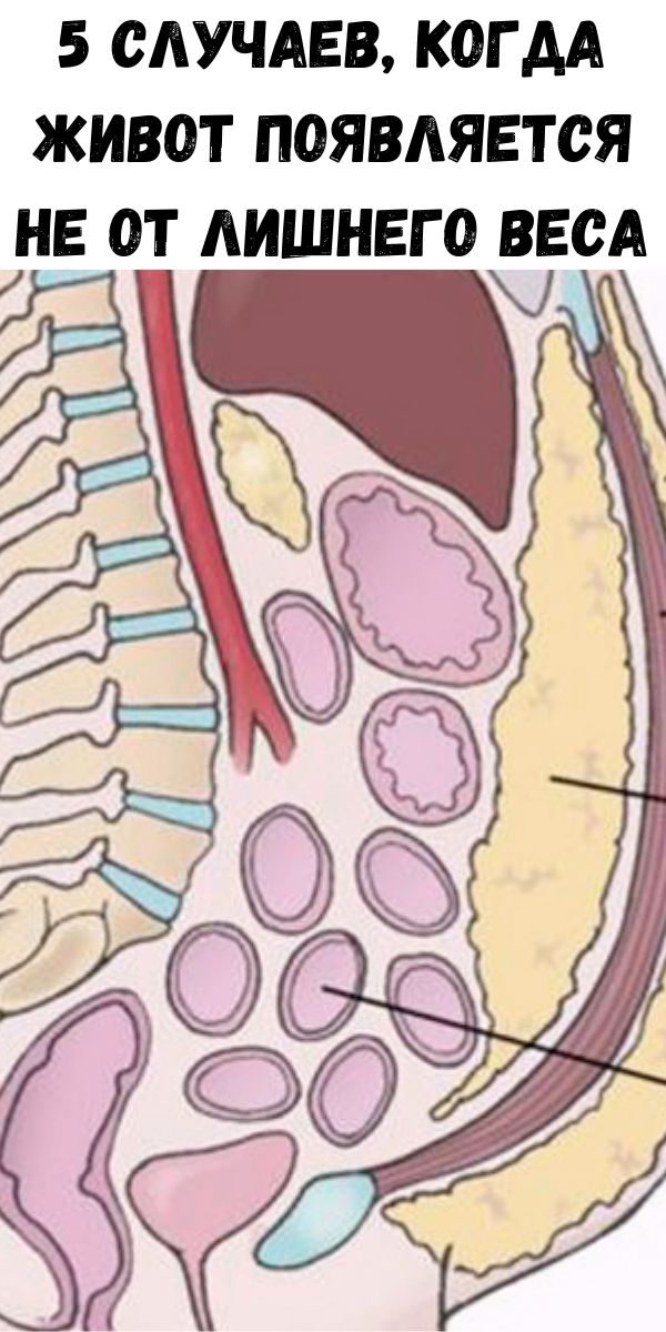 5 случаев, когда живот появляется не от лишнего веса