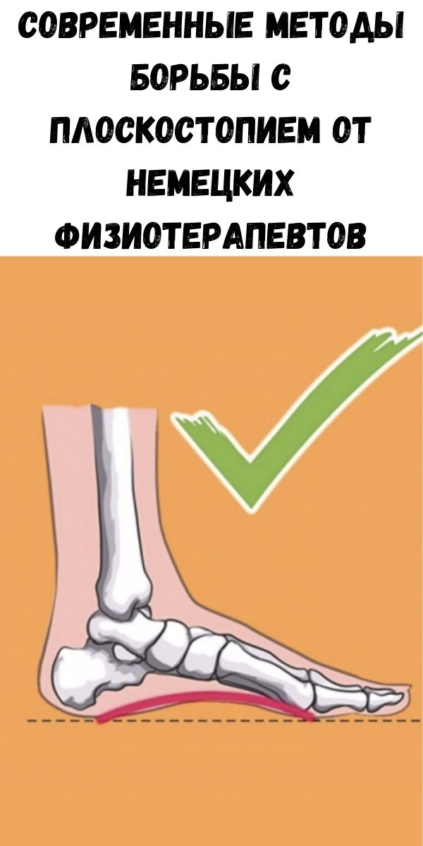Современные методы Борьбы с плоскостопием от немецких физиотерапевтов