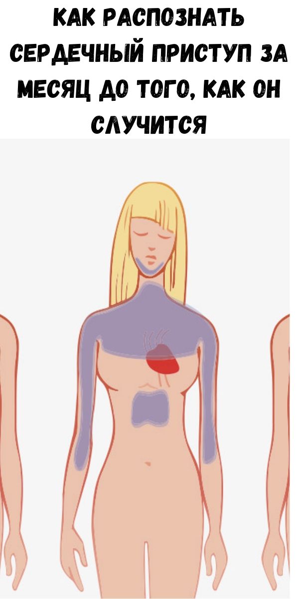 Как заранее распознать сердечный приступ. Как понять ч о болит сердце. Признаки основных заболеваний сердца. Как распознать сердечный. Как распознать сердечевй примткр.