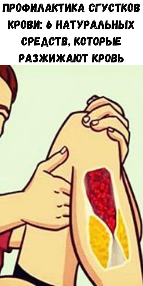 Профилактика сгустков крови: 6 натуральных средств, которые разжижают кровь