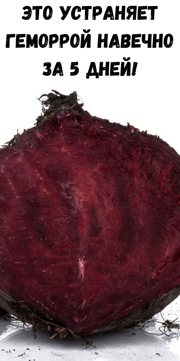 Это устраняет геморрой навечно за 5 дней! - Советы для женщин