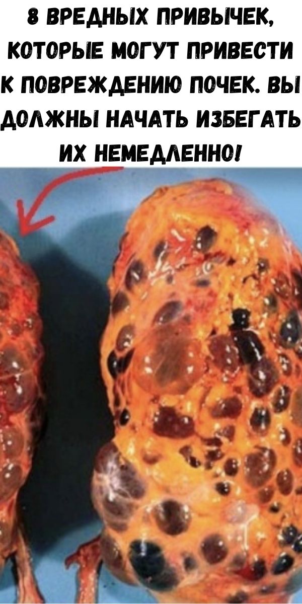 8 вредных привычек, которые могут привести к повреждению почек. Вы должны начать избегать их немедленно!