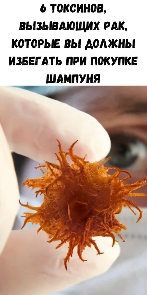 6 токсинов, вызывающих рак, которые вы должны избегать при покупке шампуня!