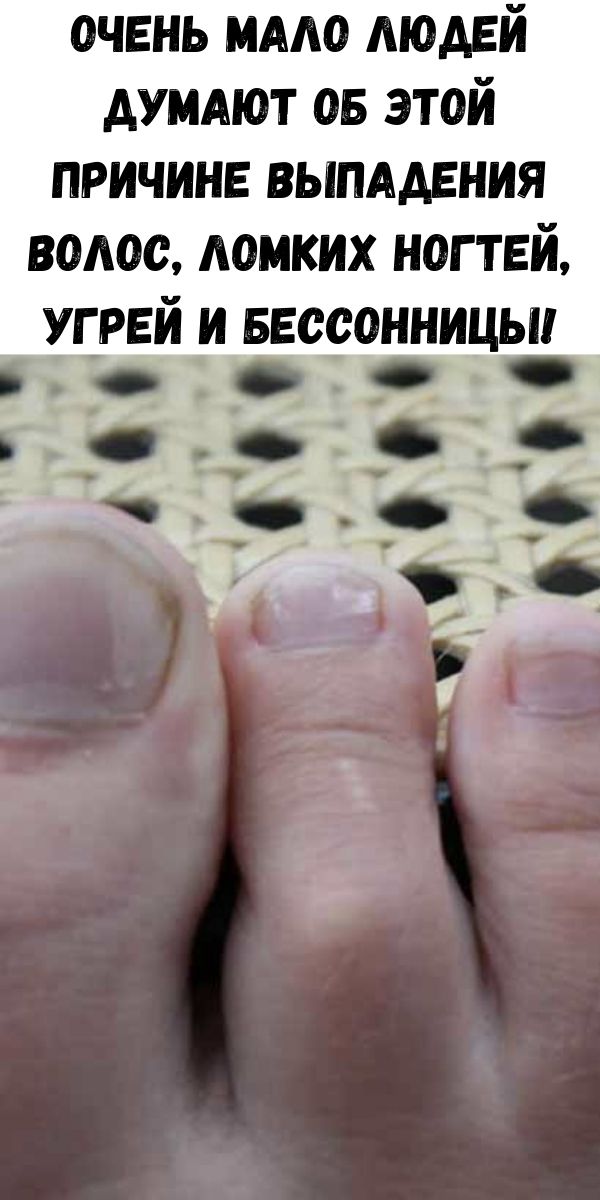 Очень мало людей думают об этой причине выпадения волос, ломких ногтей, угрей и бессонницы!