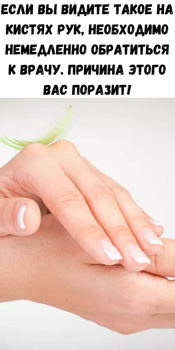 Если Вы видите такое на кистях рук, необходимо немедленно обратиться к врачу. Причина этого Вас поразит!