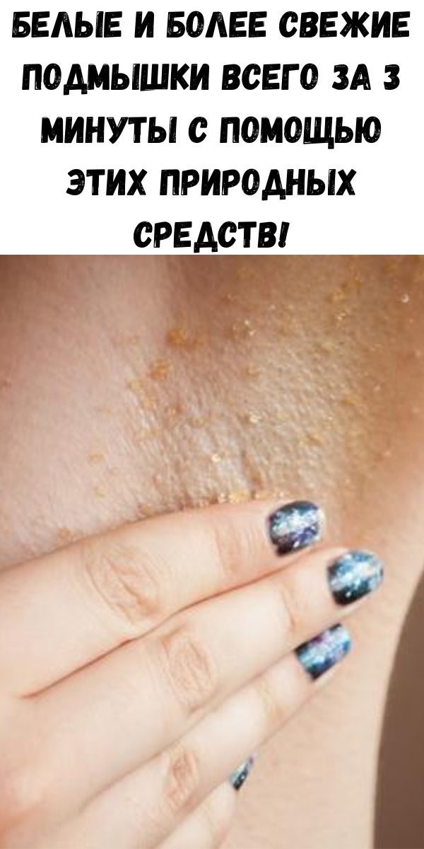 Белые и более свежие подмышки всего за 3 минуты с помощью этих природных средств!