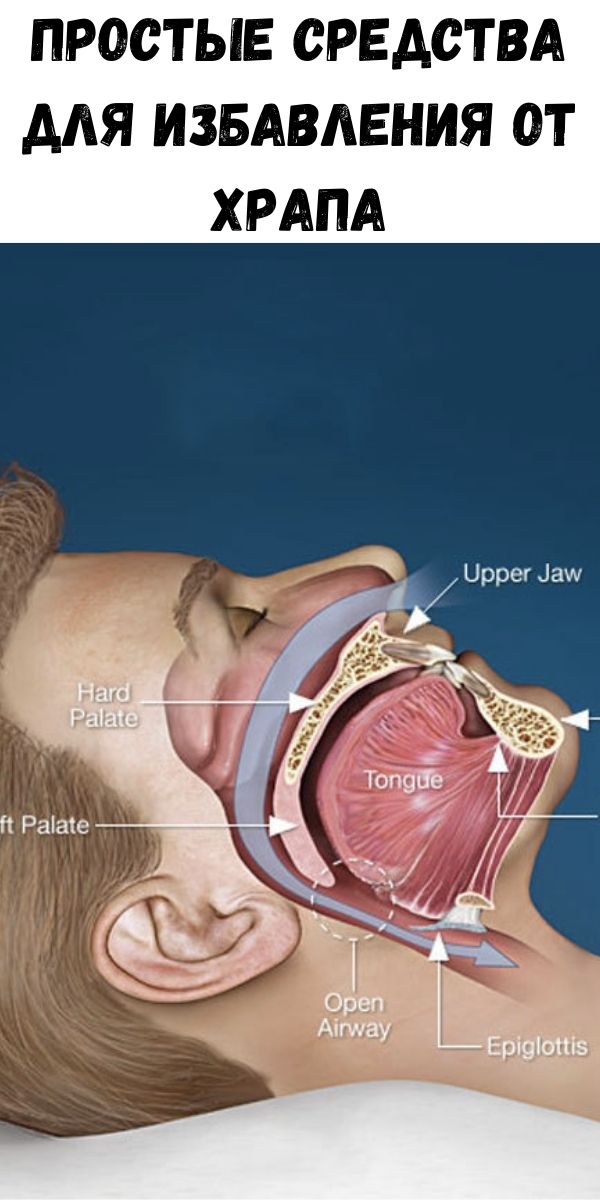Как избавиться от храпа во сне. Избавление от храпа. Упражнения для избавления от храпа.
