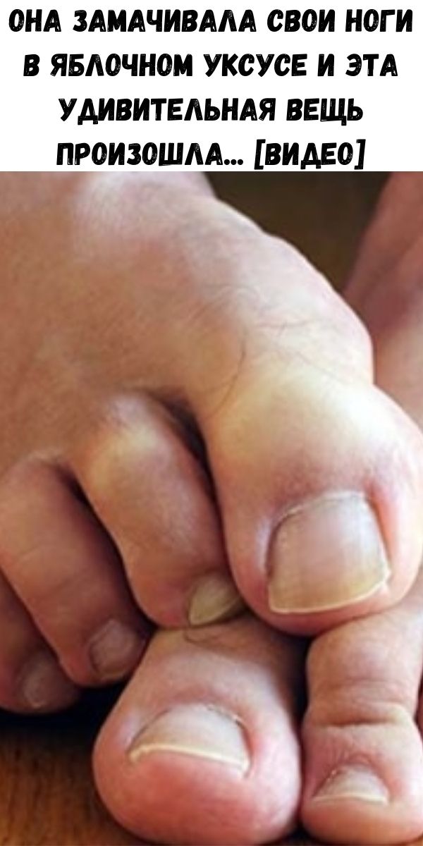 Она замачивала свои ноги в яблочном уксусе и эта удивительная вещь произошла... [видео]