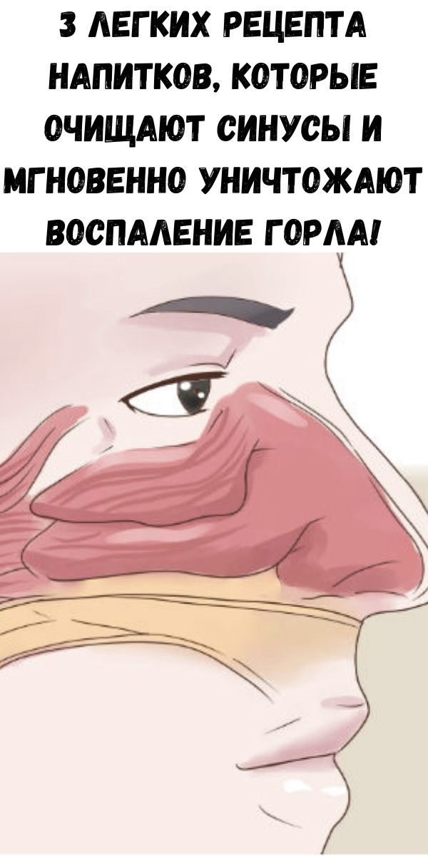 3 легких рецепта напитков, которые очищают синусы и мгновенно уничтожают воспаление горла!