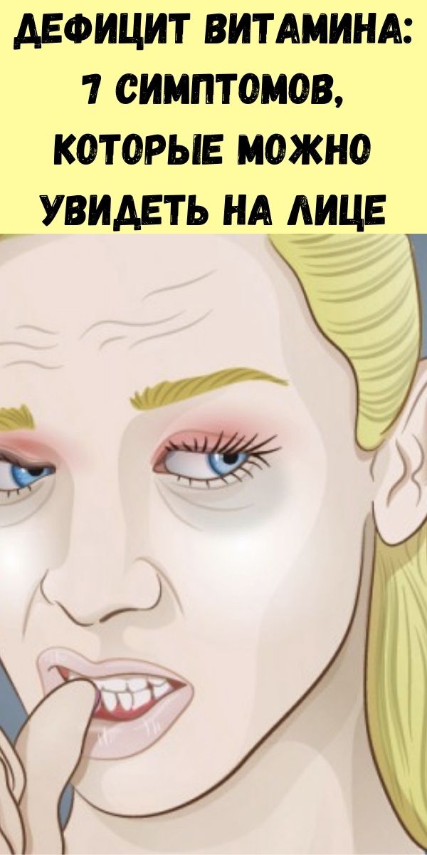 Дефицит витамина: 7 симптомов, которые можно увидеть на лице