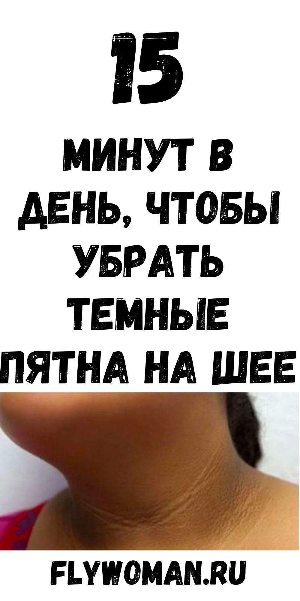 Удалите эти уродливые темные пятна на шее, подмышками и внутренней стороне бедер за 15 минут!