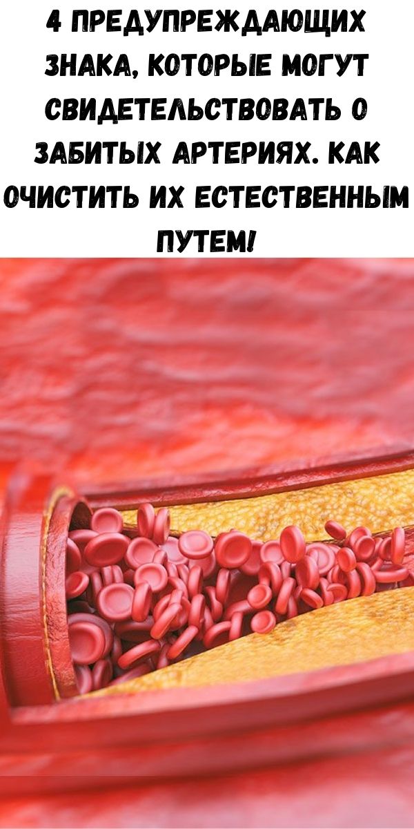 4 предупреждающих знака, которые могут свидетельствовать о забитых артериях. Как очистить их естественным путем!
