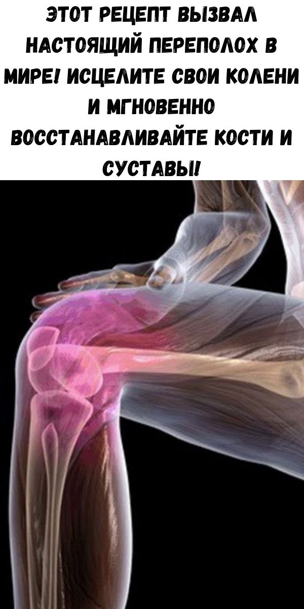 Этот рецепт вызвал настоящий переполох в мире! Исцелите свои колени и мгновенно восстанавливайте кости и суставы!