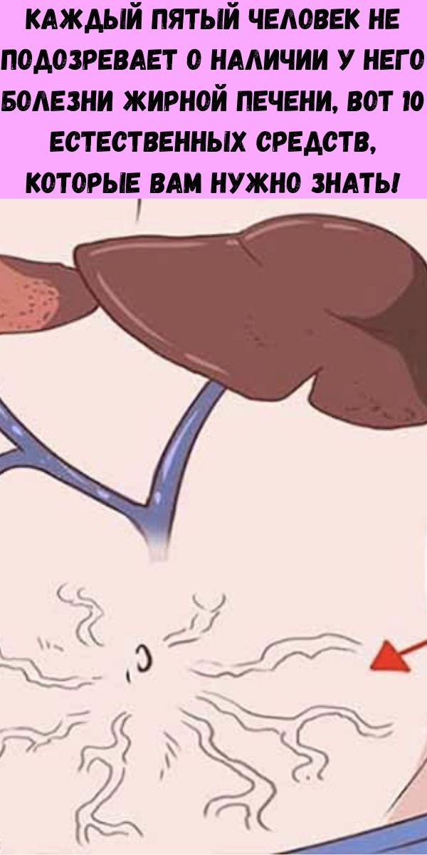 Каждый пятый человек не подозревает о наличии у него болезни жирной печени, вот 10 естественных средств, которые вам нужно знать!