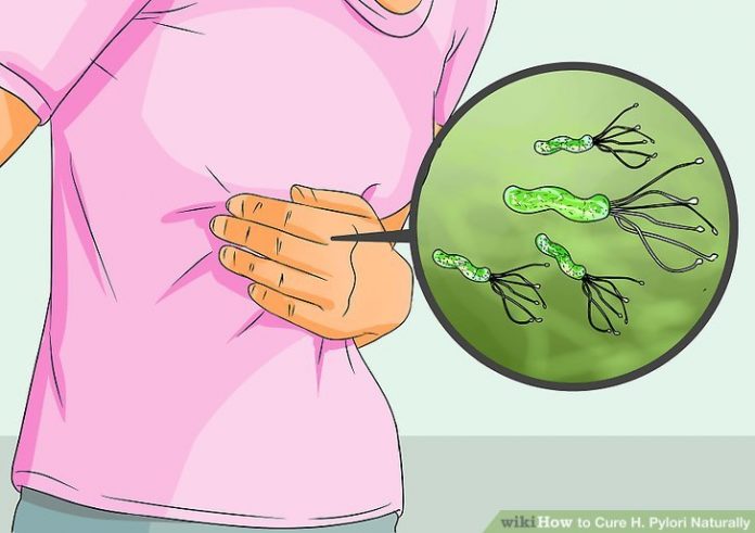 Признаки того, что у вас может быть H.Pylori в вашей кишке - как бороться с ней, естественным образом, без лекарств! Признаки того, что у вас может быть H.Pylori в вашей кишке - как бороться с ней, естественным образом, без лекарств!