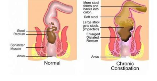 Как заставить себя сходить в туалет по большому, когда у вас мало времени Как заставить себя сходить в туалет по большому, когда у вас мало времени