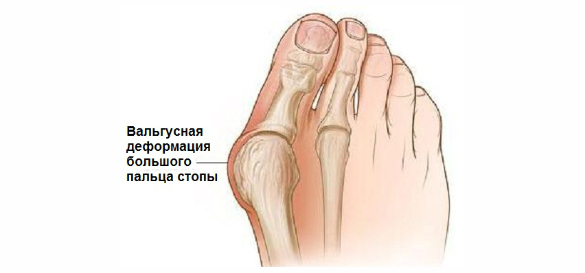 ВЫЛЕЧИТЬ ВЫЛЕЧИТЬ