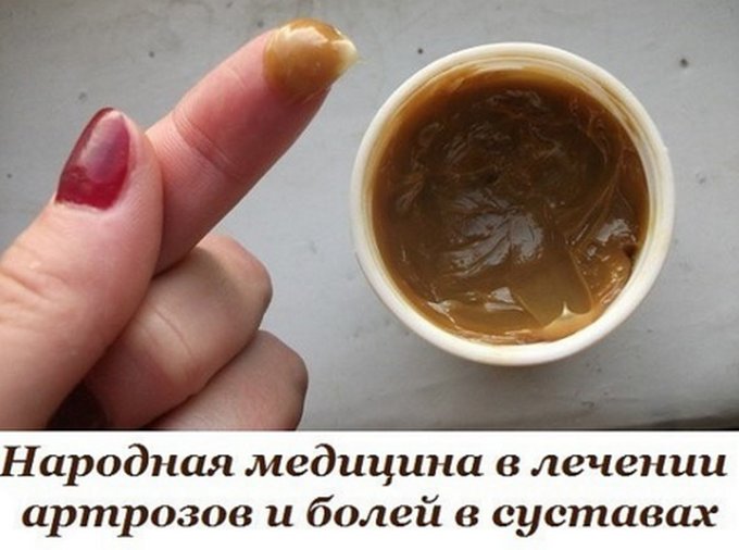 Как вылечить колено &mdash; простой, но супер-эффективный рецепт!