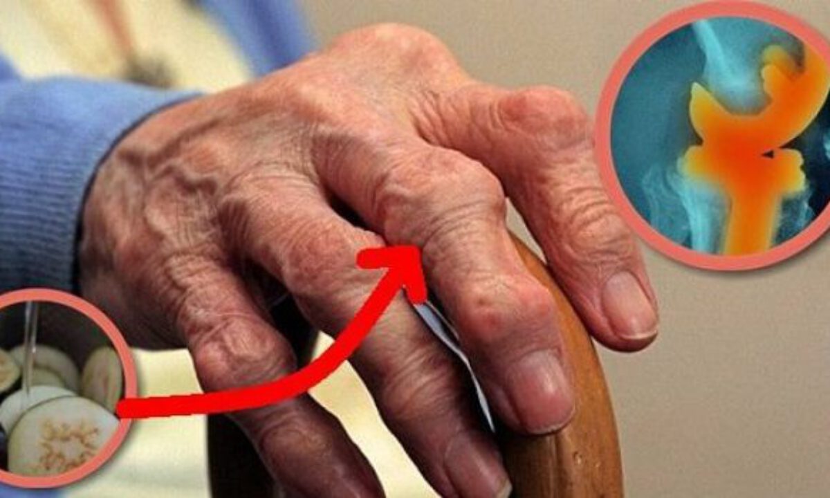 Избавьтесь от боли в суставах всего за 1 день, используя это потрясающий рецепт! Избавьтесь от боли в суставах всего за 1 день, используя это потрясающий рецепт!